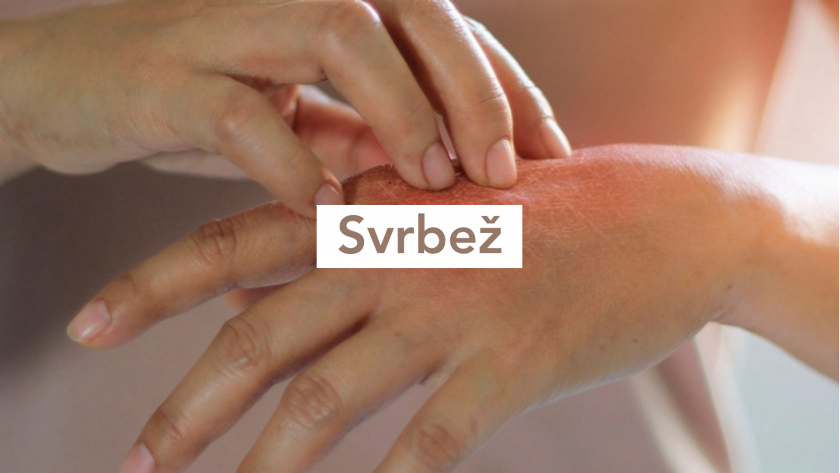 Suve Ruke Oštećene i suhe ruke: uzroci i savjeti | BIODERMA
