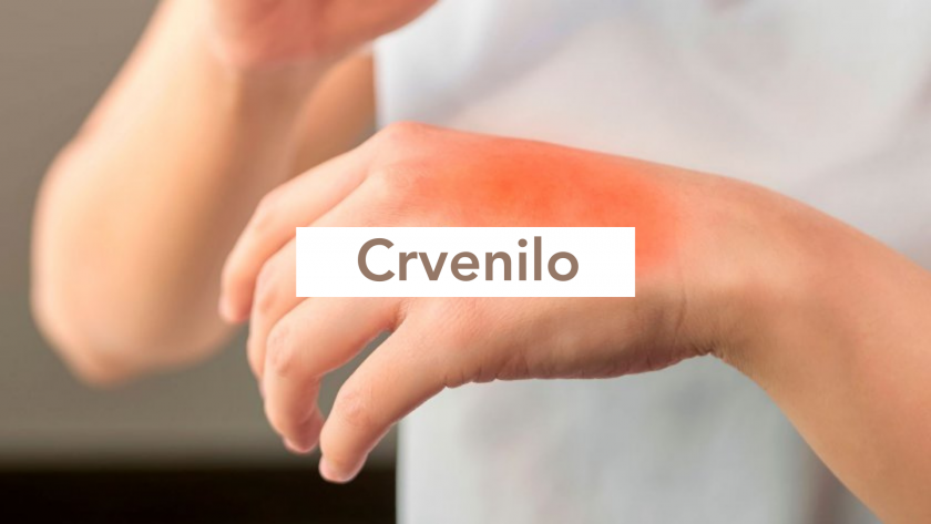 Suve Ruke Oštećene i suhe ruke: uzroci i savjeti | BIODERMA