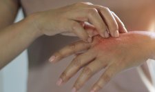 Damaged hands Damaged hands